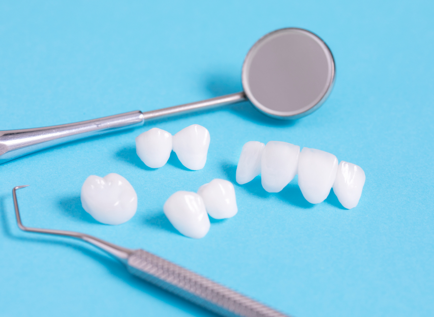 プロビジョナルレストレーションとは